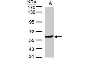 WB Image Sample(30 μg of whole cell lysate) A:Hep G2, 7. (Monoamine Oxidase B 抗体)