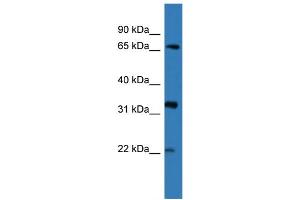 WB Suggested Anti-DOK4  Antibody Titration: 0. (DOK4 抗体  (N-Term))