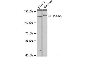Western blot analysis of extracts of various cell lines using PDE6A Polyclonal Antibody at dilution of 1:1000. (PDE6A 抗体)