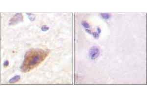 Immunohistochemistry analysis of paraffin-embedded human brain tissue, using Tyrosine Hydroxylase (Ab-8) Antibody. (Tyrosine Hydroxylase 抗体  (AA 5-54))