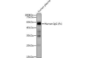 Western blot analysis of extracts of Human plasma, using Human IgG antibody (ABIN7267844) at 1:3000 dilution. (IGHG1 抗体)