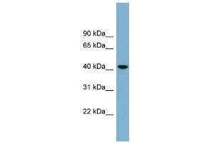 Western Blotting (WB) image for anti-UDP-Gal:betaGlcNAc beta 1,4- Galactosyltransferase, Polypeptide 2 (B4GALT2) (Middle Region) antibody (ABIN2781897)