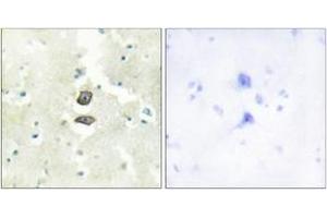 Immunohistochemistry analysis of paraffin-embedded human brain tissue, using BRI3B Antibody. (BRI3BP 抗体  (AA 1-50))