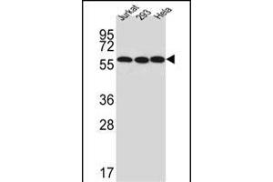 Western blot analysis of UTP6 Antibody (N-term) (ABIN651489 and ABIN2840264) in Jurkat,293,Hela cell line lysates (35 μg/lane). (UTP6 抗体  (N-Term))