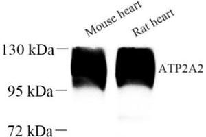 Western blot analysis of ATP2A2 (ABIN7075545) at dilution of 1: 500 (SERCA2 ATPase 抗体)