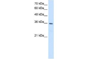 MTHFD2 antibody used at 1. (MTHFD2 抗体)