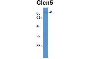 Host:  Rabbit  Target Name:  Clcn5  Sample Type:  Rat Lung  Antibody Dilution:  1.