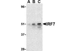 Western blot analysis of IRF7 in 293 whole cell lysate with AP30449PU-N IRF7 antibody at (A) 0. (IRF7 抗体  (C-Term))