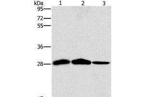 Western Blot analysis of Mouse liver and Human chromaffin cell tumor tissue, hepG2 cell using SPR Polyclonal Antibody at dilution of 1:1500 (SPR 抗体)