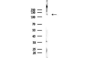 Western blot analysis of lysates from Mouse liver, using Collagen III Antibody at 1/1000 dilution.