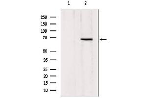 Western blot analysis of extracts from Mouse Myeloma cell, using MTA3 antibody. (MTA3 抗体  (Internal Region))