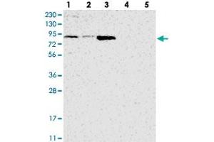 Western blot analysis of Lane 1: RT-4, Lane 2: U-251 MG, Lane 3: Human Plasma, Lane 4: Liver, Lane 5: Tonsil with ATAD2B polyclonal antibody  at 1:250-1:500 dilution. (ATAD2B 抗体)