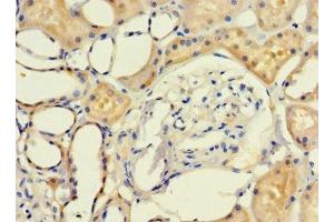 Immunohistochemistry of paraffin-embedded human kidney tissue using ABIN7158049 at dilution of 1:100 (LRCH1 抗体  (AA 1-105))