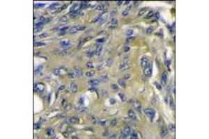 Immunohistochemistry (Paraffin-embedded Sections) (IHC (p)) image for anti-C-Fos Induced Growth Factor (Vascular Endothelial Growth Factor D) (Figf) (C-Term) antibody (ABIN358813)