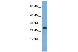 WB Suggested Anti-ANKRD39 Antibody Titration: 0. (ANKRD39 抗体  (N-Term))