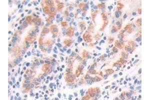 Immunohistochemistry (IHC) image for anti-Enoyl Coenzyme A Hydratase 1, Peroxisomal (ECH1) (AA 1-328) antibody (ABIN7443788)