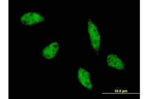 Immunofluorescence of monoclonal antibody to TFAP2B on HeLa cell. (TFAP2B 抗体  (AA 1-449))