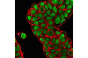 Immunofluorescence Analysis of PFA-fixed MCF-7 cells stained with Nucleolin MAb (364-5 + NCL/902) followed by Goat anti-Mouse IgG-CF488 (Green). (Nucleolin 抗体)