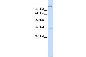 ATP10D antibody used at 1 ug/ml to detect target protein. (ATP10D 抗体  (C-Term))