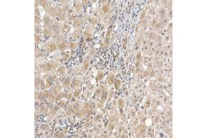 Immunohistochemistry of paraffin-embedded human liver using DC Rabbit mAb (ABIN7266685) at dilution of 1:200 (40x lens). (DCAF7 抗体)