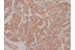 DAB staining on IHC-P; Samples: Mouse Skeletal muscle Tissue (FES 抗体  (AA 510-770))