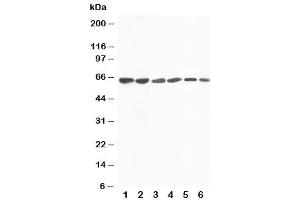Western blot testing of FMO4 antibody and Lane 1:  rat liver (FMO4 抗体  (N-Term))