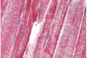 Human Skeletal Muscle (formalin-fixed, paraffin-embedded) stained with UNC93B antibody ABIN343917 at 5 ug/ml followed by biotinylated goat anti-rabbit IgG secondary antibody ABIN481713, alkaline phosphatase-streptavidin and chromogen. (UNC93B1 抗体  (N-Term))