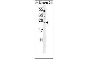 Western Blotting (WB) image for anti-Polymerase (RNA) II (DNA Directed) Polypeptide J, 13.3kDa (POLR2J) (AA 93-117), (C-Term) antibody (ABIN954242)