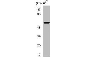 Western Blot analysis of HeLa cells using TBC1D3A/B/C Polyclonal Antibody (TBC1D3/TBC1D3B/TBC1D3C (C-Term) 抗体)