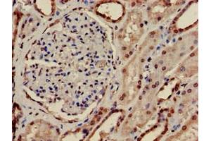 Immunohistochemistry (IHC) image for anti-phosphoribosyl Pyrophosphate Synthetase 2 (PRPS2) (AA 11-106) antibody (ABIN7168160)
