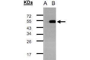 WB Image Western Blot analysis of TADA3L expression in transfected 293T cell line by TADA3L polyclonal antibody. (TADA3L 抗体  (C-Term))
