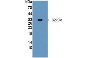 ABCC8 antibody  (AA 679-929)