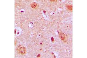 Immunohistochemical analysis of PTGR2 staining in human brain formalin fixed paraffin embedded tissue section. (PTGR2 抗体  (Center))