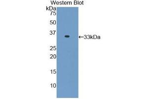Western blot analysis of the recombinant protein. (TNNI3 抗体  (AA 1-211))