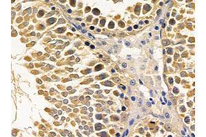 ABIN6257100 and ABIN6275625 at 1/100 staining rat testis tissue by IHC-P. (CCT8 抗体  (Internal Region))