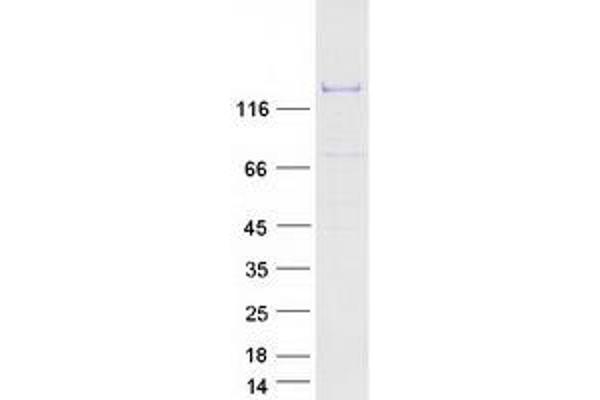 DNA Helicase B Protein (HELB) (Myc-DYKDDDDK Tag)