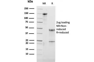 SDS-PAGE (SDS) image for anti-Tumor Necrosis Factor Receptor Superfamily, Member 4 (TNFRSF4) (AA 59-205) antibody (ABIN6940817)
