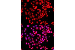 Immunofluorescence analysis of  cells using RPS6KL1 antibody (ABIN6130681, ABIN6147242, ABIN6147243 and ABIN6223376). (RPS6KL1 抗体  (AA 1-130))
