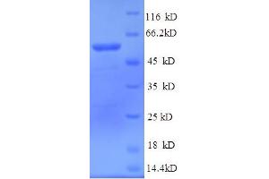 SDS-PAGE (SDS) image for 5'-Nucleotidase, Cytosolic IA (NT5C1A) (AA 1-368), (full length) protein (His tag) (ABIN5714472)