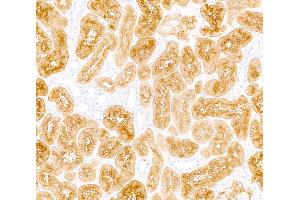 Immunohistochemistry (IHC) image for anti-Dipeptidyl-Peptidase 4 (DPP4) (AA 29-766) antibody (ABIN7795691) (Recombinant DPP4 抗体  (AA 29-766))