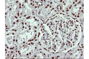 Image no. 8 for anti-THUMP Domain Containing 1 (THUMPD1) antibody (ABIN1501384) (THUMPD1 抗体)