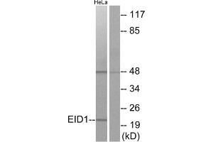 Western blot analysis of extracts from HeLa cells, using EID1 antibody. (EID1 抗体  (Internal Region))