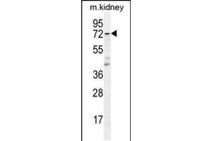 Western blot analysis in mouse kidney tissue lysates (35ug/lane). (TBXAS1 抗体  (AA 226-257))