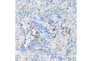 Immunohistochemistry of paraffin-embedded Mouse cartilage using Aggrecan Rabbit pAb (ABIN6127417, ABIN6136406, ABIN6136408 and ABIN6224631) at dilution of 1:50 (40x lens). (Aggrecan 抗体  (AA 20-280))