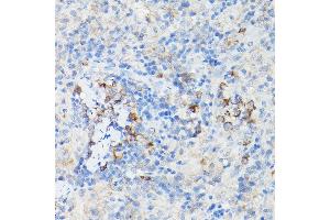 Immunohistochemistry of paraffin-embedded Mouse cartilage using Aggrecan Rabbit pAb (ABIN6127417, ABIN6136406, ABIN6136408 and ABIN6224631) at dilution of 1:50 (40x lens). (Aggrecan 抗体  (AA 20-280))