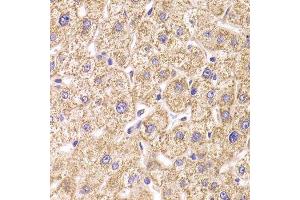 Immunohistochemistry of paraffin-embedded human liver injury using ST3GAL3 antibody. (ST3GAL3 抗体  (AA 30-375))