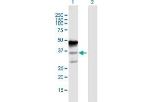 Western Blot analysis of MAGEA8 expression in transfected 293T cell line by MAGEA8 MaxPab polyclonal antibody. (MAGEA8 抗体  (AA 1-318))
