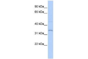 WB Suggested Anti-RNF113A Antibody Titration:  0. (RNF113A 抗体  (Middle Region))