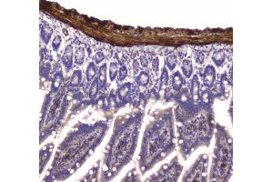 Immunohistochemistry (IHC) image for anti-Myosin Light Chain Kinase (MYLK) (AA 1441-1709) antibody (ABIN5693029)