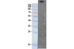 Western Blotting (WB) image for anti-CREB Binding Protein (CREBBP) (acLys1535) antibody (ABIN6281375) (CBP 抗体  (acLys1535))